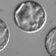 Embryos after co-injection developing into blastocysts, which could someday be used in fertility clinics to help people trying to have children free of genetic disease.